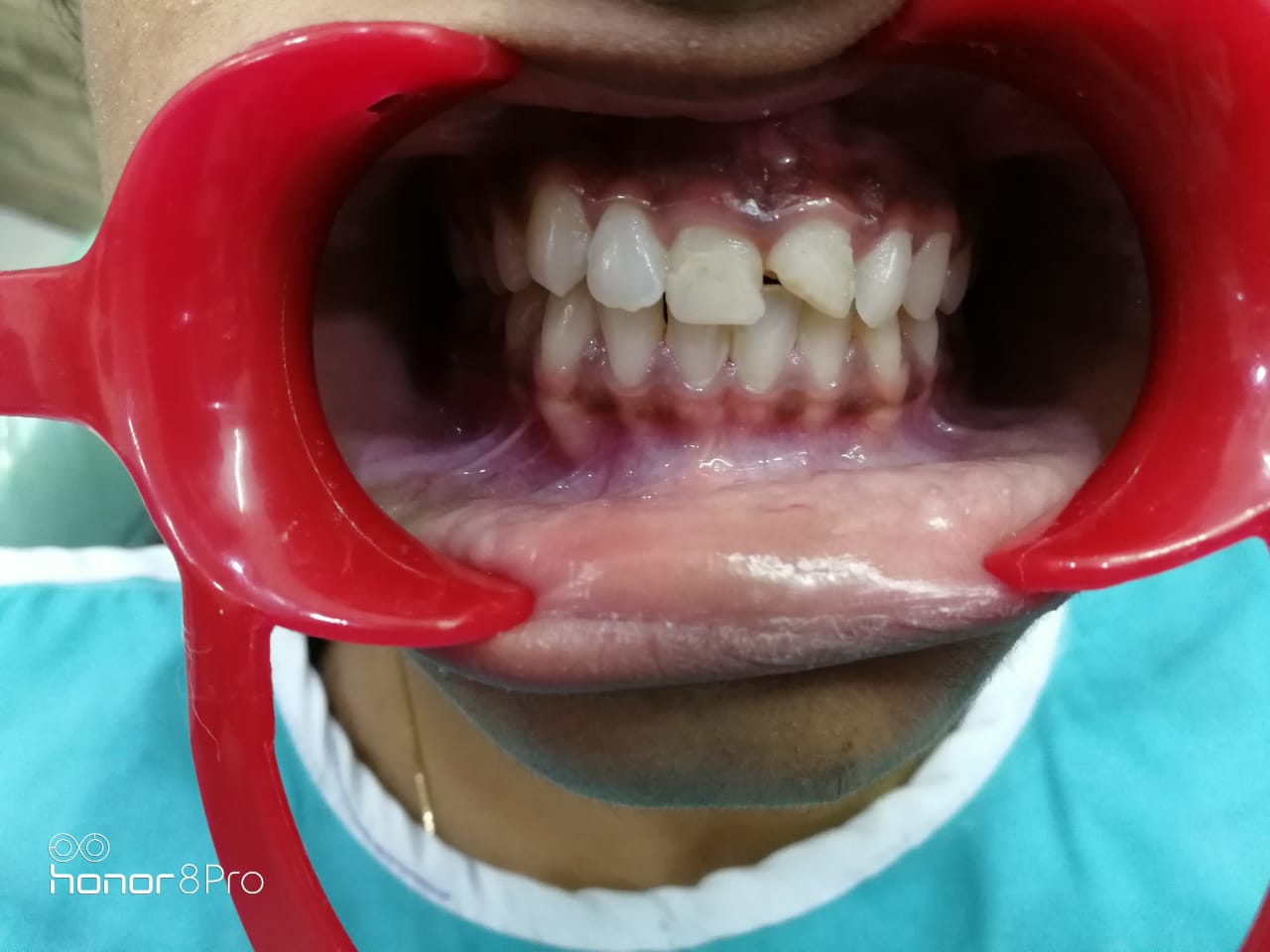 Aesthetic dental makeover before