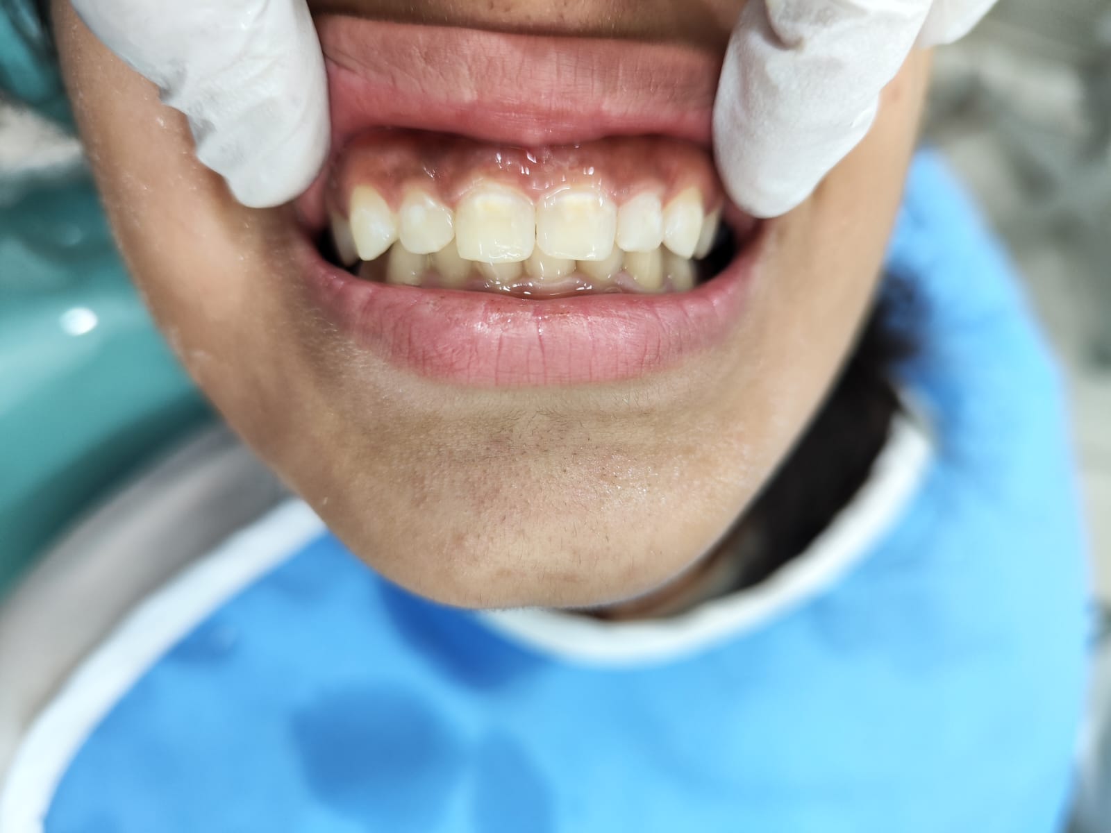 Case 10 after