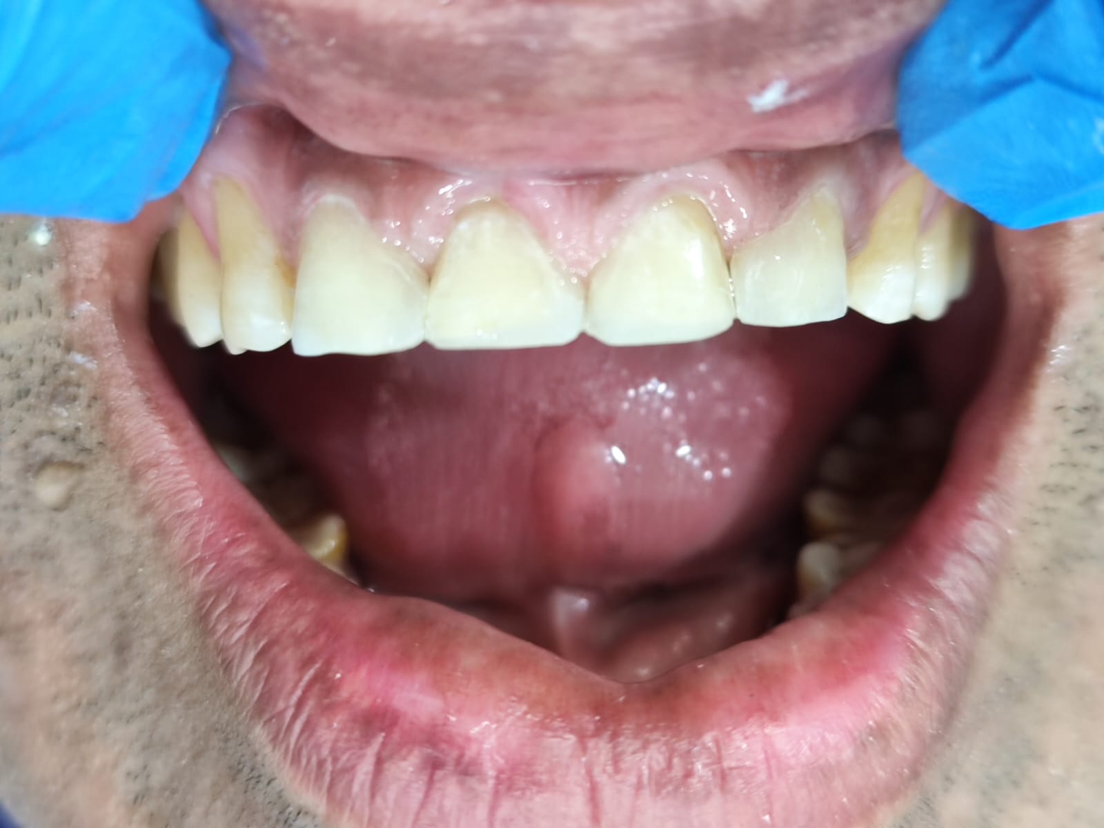 Case 2 after