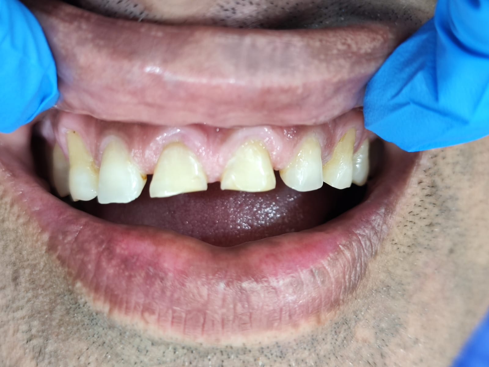 Case 2 before
