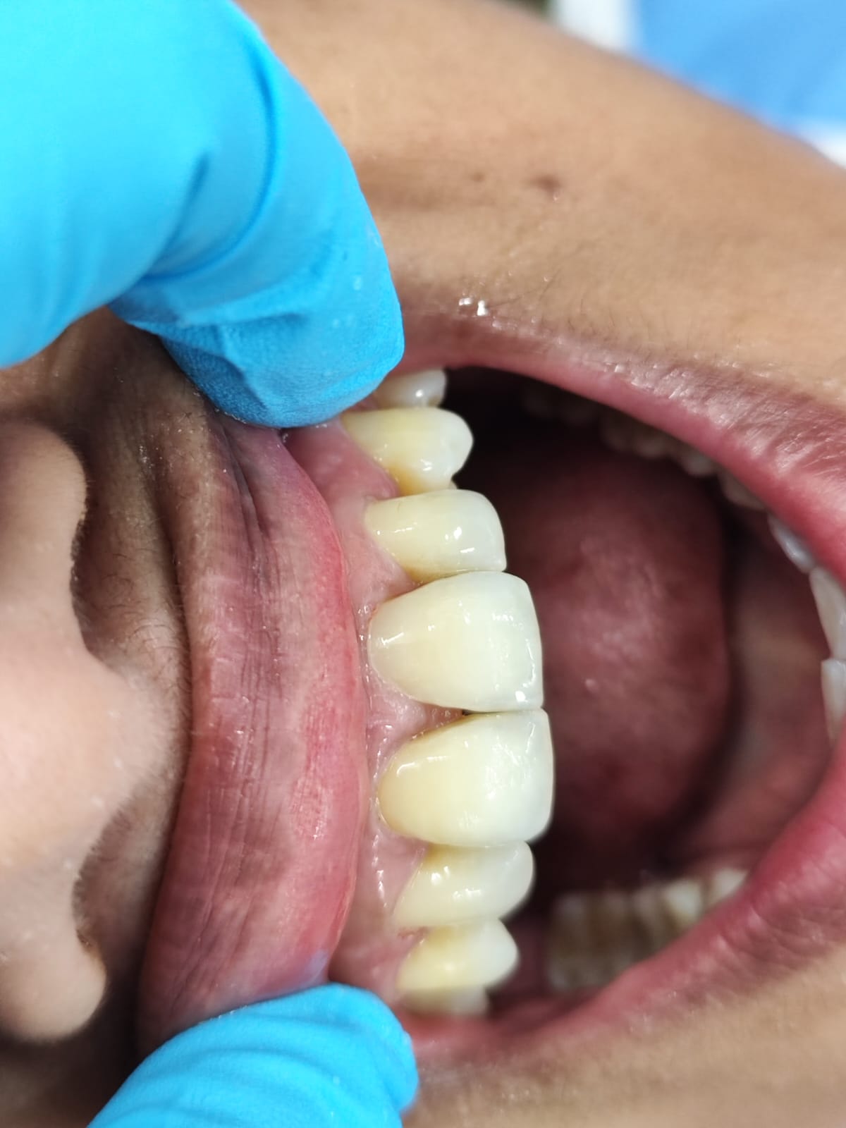 Case 7 after
