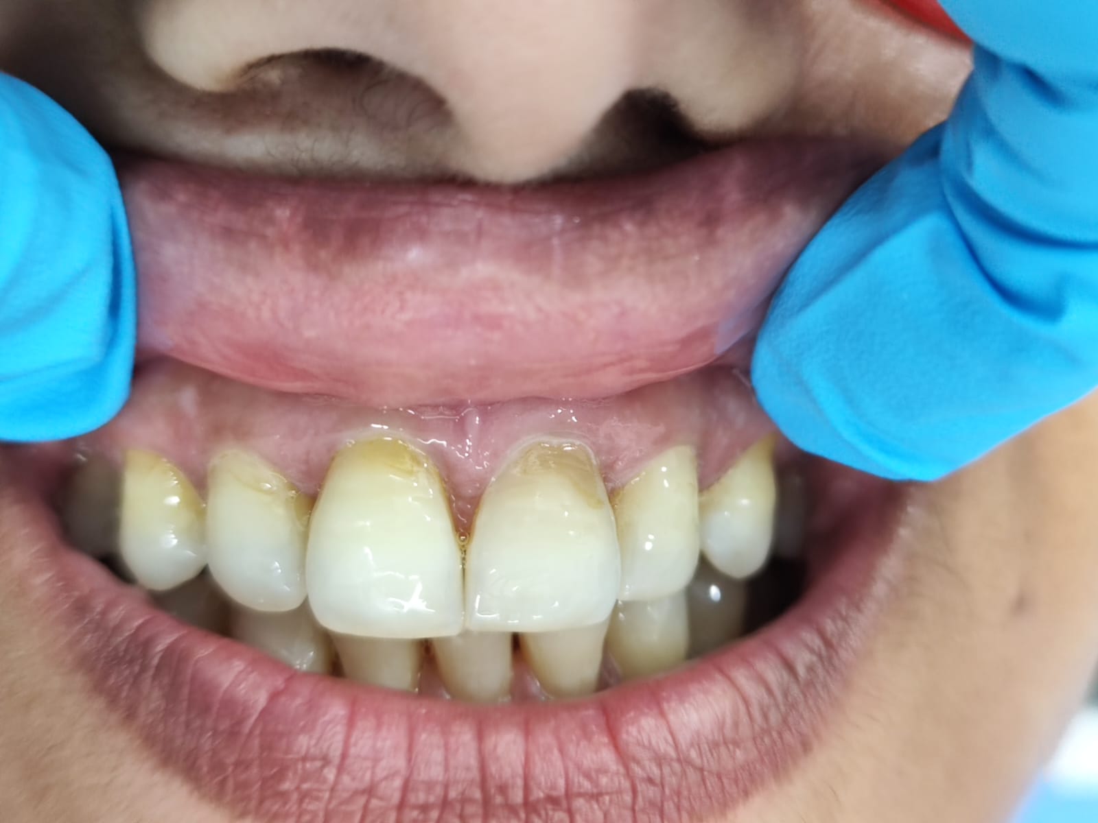 Case 7 before