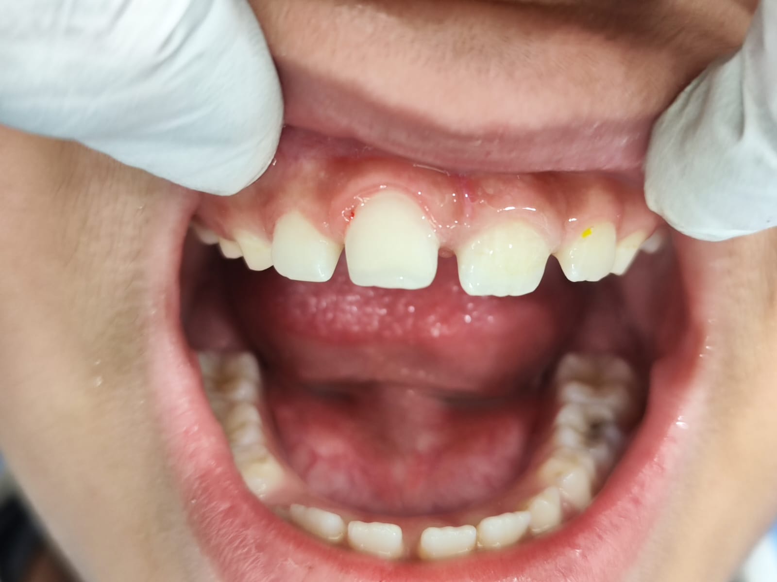 Case 8 after