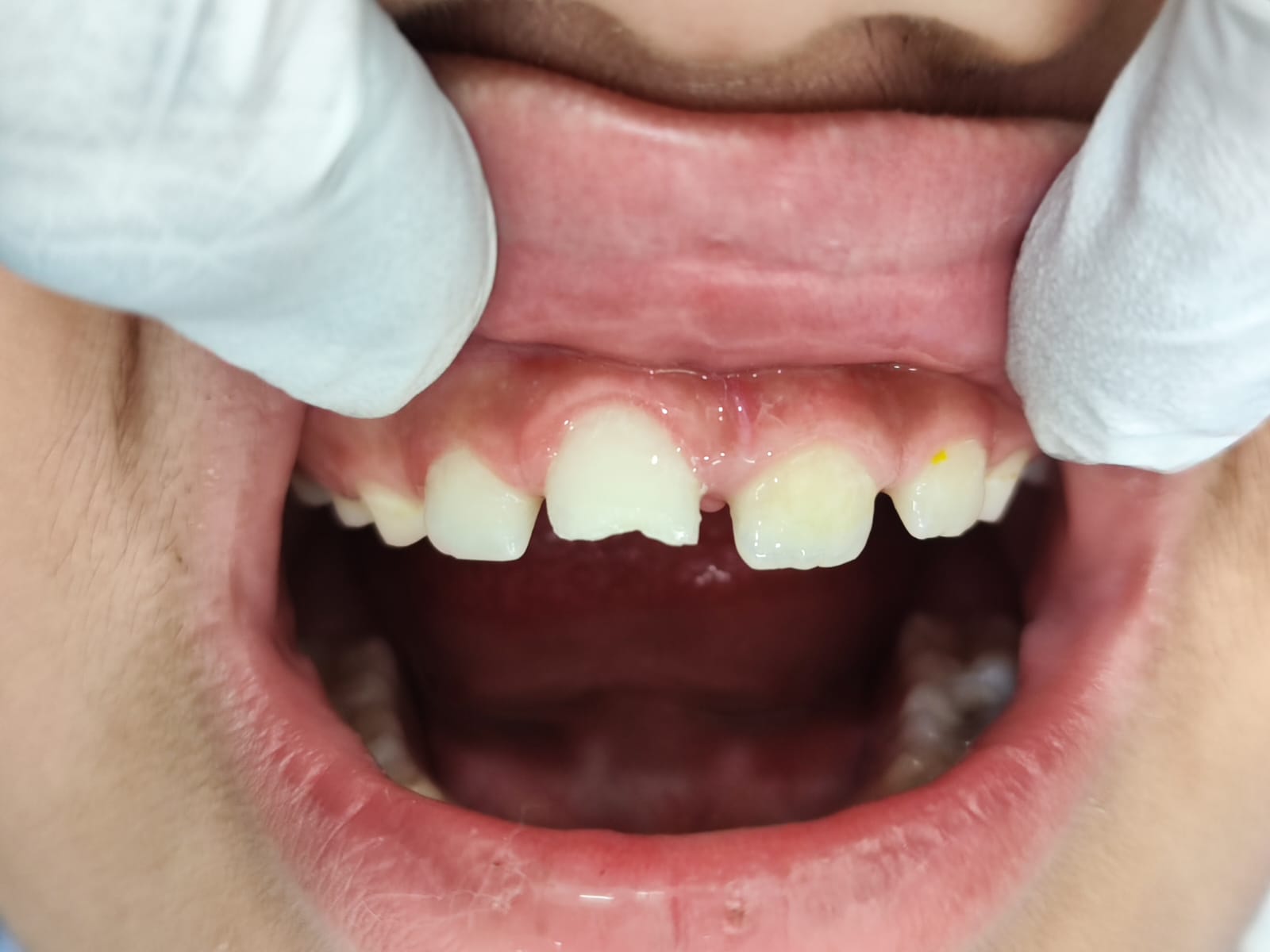 Case 8 before