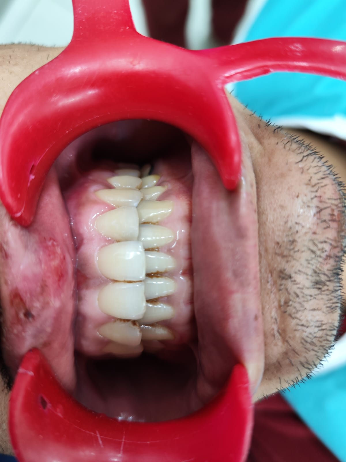 Case 9 after