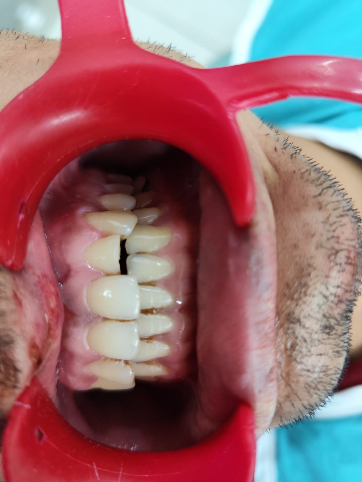 Case 9 before