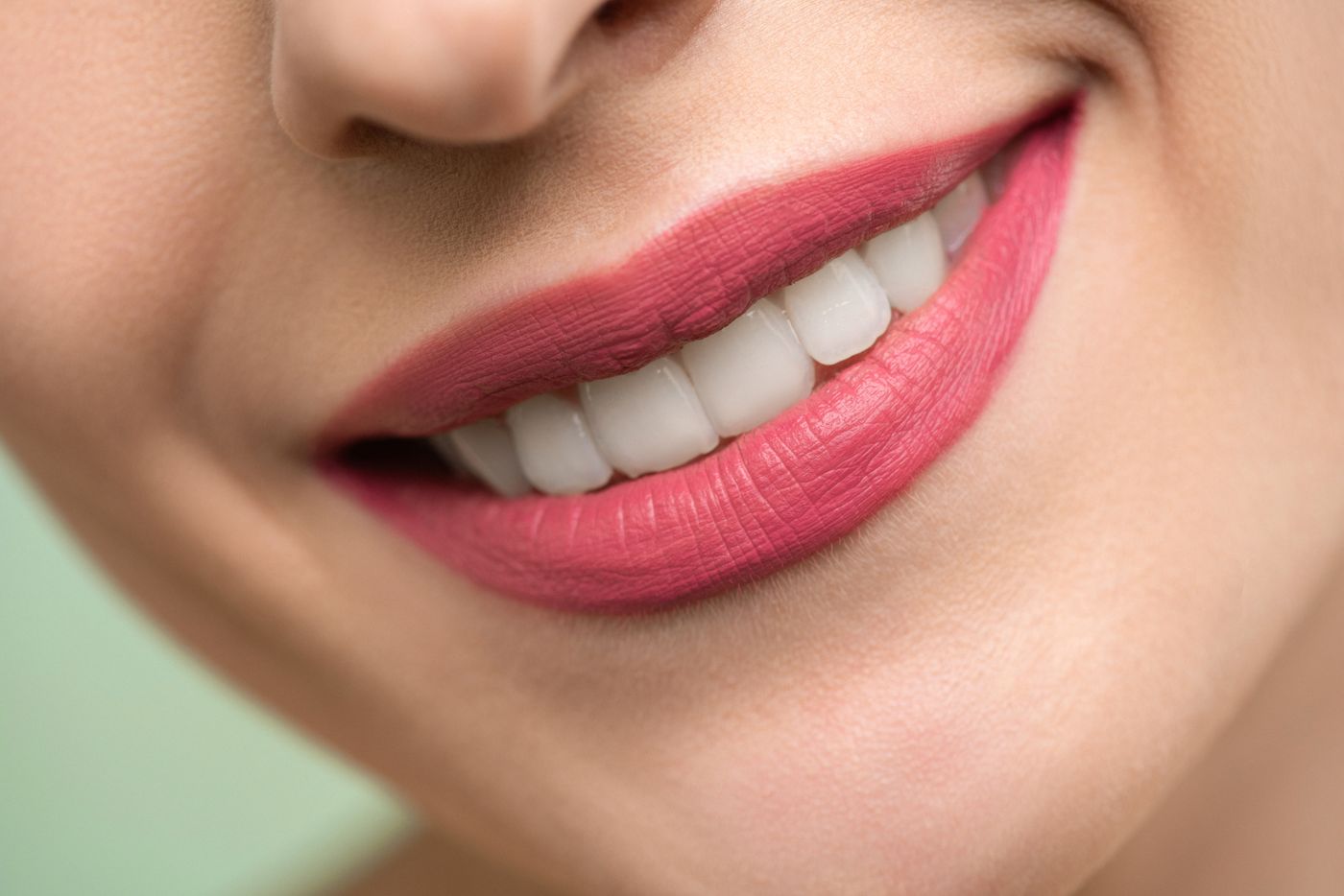 Cosmetic smile